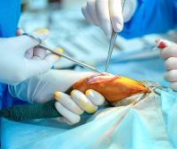 Orthopedic Surgery