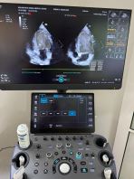 Echocardiography