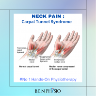 Carpal Tunnel Syndrome / Finger numbness