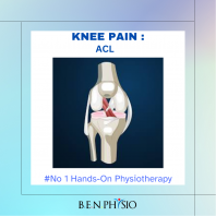 ACL Injury