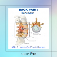 Bone Spur