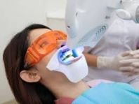 Teeth Whitening