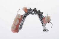 Cobalt Chrome Denture