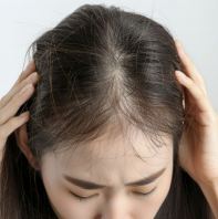 Hair Growth Scalp Treatment