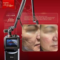 Medi Clinic's Co2 Laser