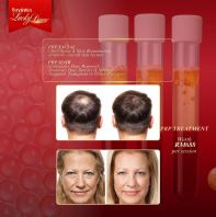 Medi Clinic's PRP Treatment for Facial & Hair