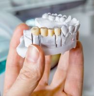 Dental Bridge