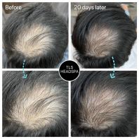 Testimoni Pelanggan & Hasil Rawatan Sebenar Head Spa di Seremban, Negeri Sembilan