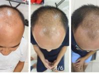 Hasil Hair Wash, Rawatan Kulit Kepala & Signature Head Therapy di Seremban, Negeri Sembilan