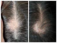 Pengalaman Head Spa Mewah & Hasil Rawatan Pelanggan di Seremban