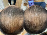 Relaks, Pulih, Segar Semula   Hasil Sebenar Rawatan Head Spa Pelanggan di Seremban