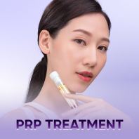 PRP Treatment