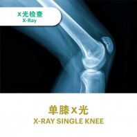Single Knee X-ray