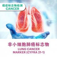 Lung Cancer Marker (CYFRA 21-1)