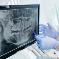 �ͷ�������X���飨Safe Scan JB������ɽ Johor Bahru Idea Dental��Mount Austin & Taman Pelangi��