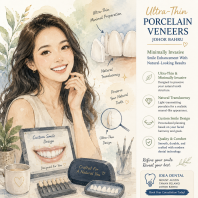 Ultra-Thin Porcelain Veneers