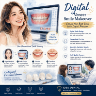 Digital Veneer Smile Makeover