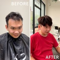 Invisible Hair Wig Transformation | Hair Loss Solution in Kuala Lumpur, Selangor, Johor Malaysia