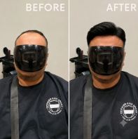 Premium Elite Wig Before & After | Hair Wigs King Malaysia