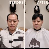 Invisible Hair Wig Transformation | Hair Loss Solution in Kuala Lumpur, Selangor, Johor & Singapore